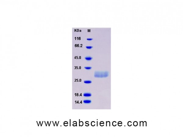 Recombinant Human C1QB / C1qB Protein (His tag)