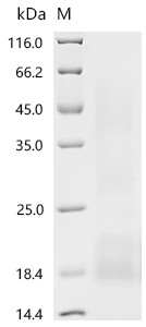Myosin regulatory light chain 12B(MYL12B), recombinant human
