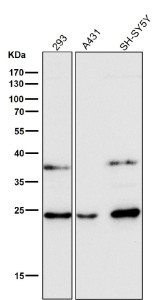Anti-GSTA4 / Glutathione S-transferase alpha 4, clone 31G31