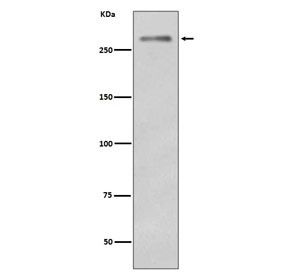 Anti-Dysferlin / DYSF, clone EGO-4