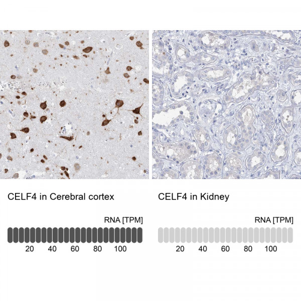 Anti-CELF4