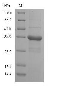 Putative 40S ribosomal protein S10-like (RPS10P5), human, recombinant