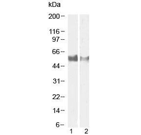 Anti-LAG3 / CD223