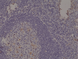 Anti-Spastin (human), Rabbit Monoclonal (RM346)