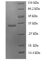 Ubiquitin-conjugating enzyme E2 variant 2 (UBE2V2), human, recombinant