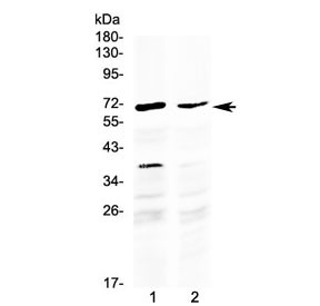 Anti-MAK / Male germ cell-associated kinase (C-Terminal Region)