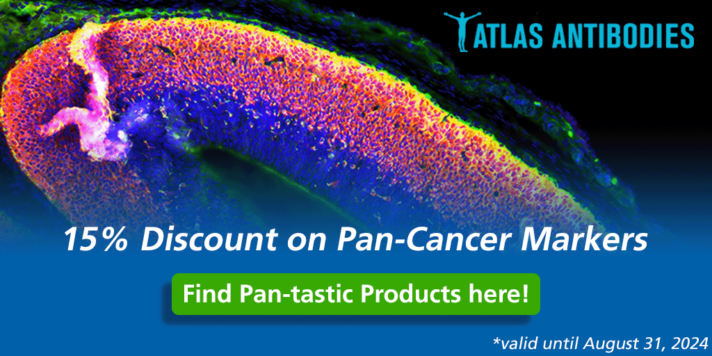 Atlas Antibodies Pan Cancer Markers