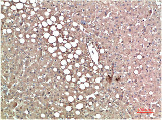 Anti-TTR Monoclonal
