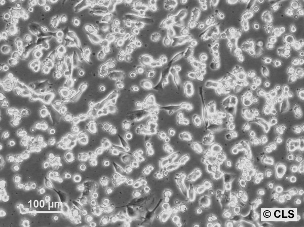 MEL-CLS-3 Cells
