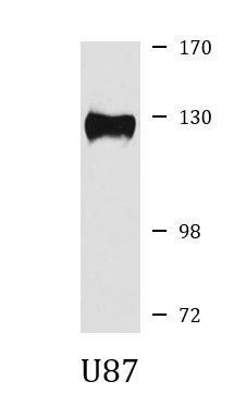 Anti-PITRM1