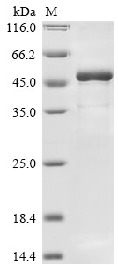 Matrix protein (M), Rabies virus, recombinant