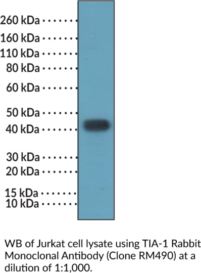 Anti-TIA-1 Rabbit (Clone RM490)