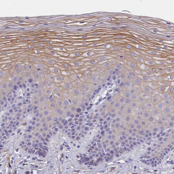 Anti-MVB12A