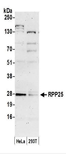 Anti-RPP25