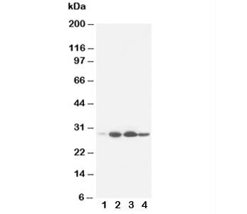 Anti-Bcl-2, clone BL-2