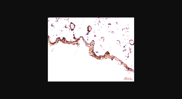 Anti-PDGFRalpha (5D1), monoclonal