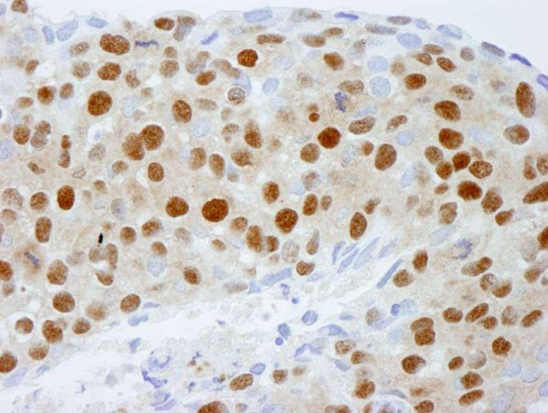 Anti-DDB1 (IHC)