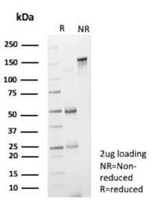 Anti-CD19 / B lymphocyte antigen CD19, clone CD19/13031R