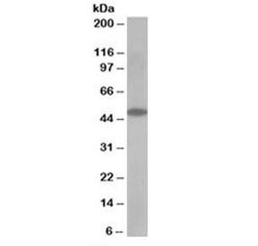 Anti-OSBPL1A