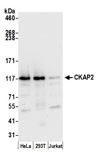 Anti-CKAP2