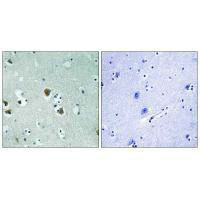 Anti-DPYSL2 (Ab-509)