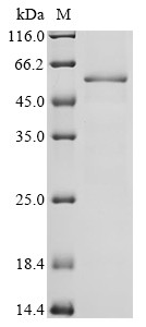 Cytochrome P450 2E1 (Cyp2e1), partial, mouse, recombinant