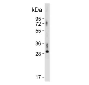 Anti-Thyroxine 5-deiodinase / DIO3