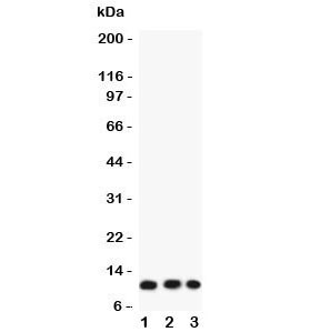 Anti-Eotaxin 3