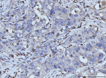 Anti-PLD3 / 5-3 exonuclease PLD3