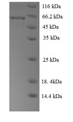 Regulator of G-protein signaling 7 (RGS7), human, recombinant