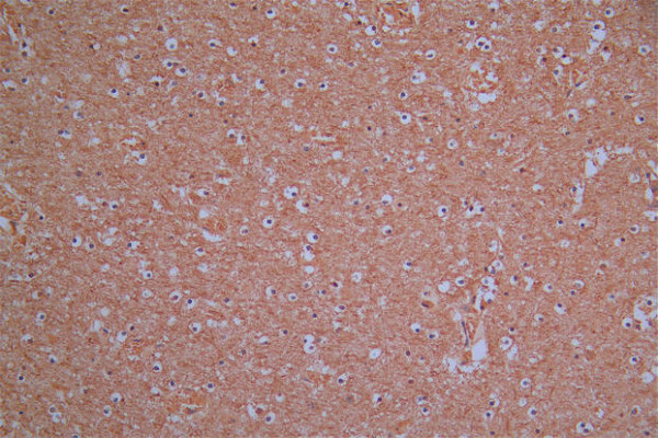 Anti-ROBO1 Recombinant Monoclonal, clone 22D5