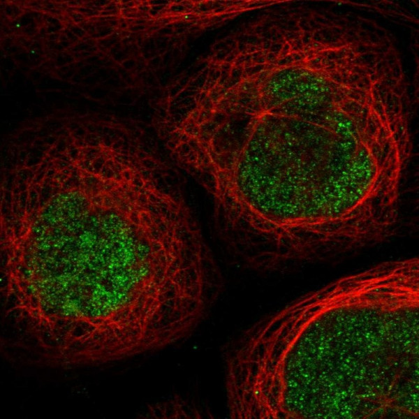 Anti-SCML1