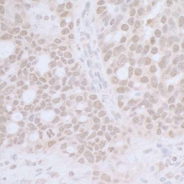 Anti-CTR9 (IHC)