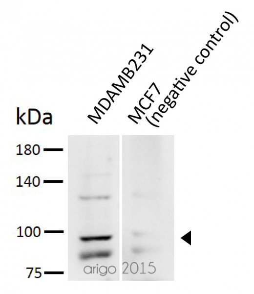 Anti-MMP9, clone 331CT17.4.4