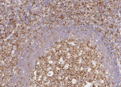 Anti-CCR1 Monoclonal Recombinant Antibody