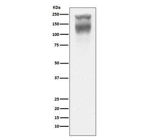 Anti-CEA / Carcinoembryonic Antigen, clone AAOA-3