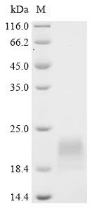 Vigilin (HDLBP), partial, human, recombinant