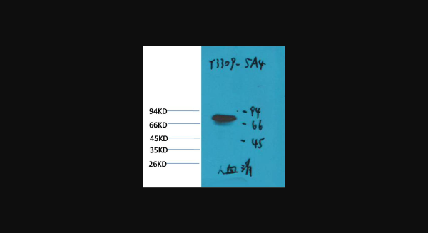 Anti-Transferrin, monoclonal