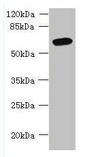 Anti-FAM149B1