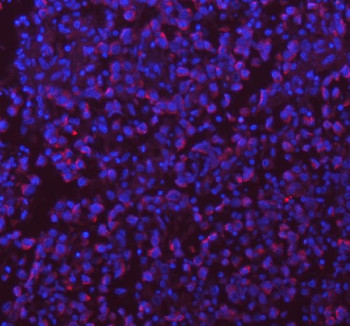 Anti-SASS6 / Spindle assembly abnormal protein 6