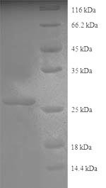 Collagen alpha-2 (IV) chain (COL4A2), partial, human, recombinant