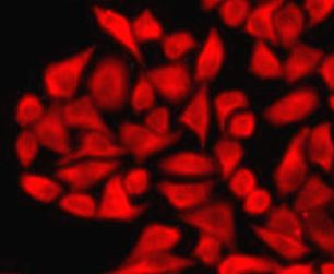 Anti-UGT1A1