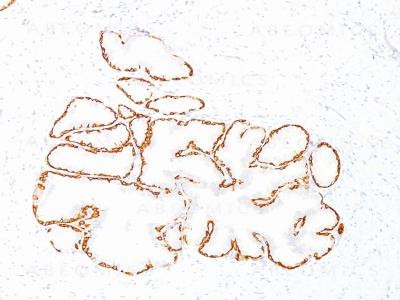 Anti-Cytokeratin 14 (KRT14) (Squamous Cell Marker)(Clone: SPM263)
