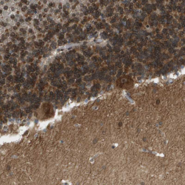 Anti-CACNB4