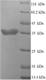 Interferon alpha-4 (IFNA4), partial, human, recombinant