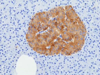 Anti-SV2A, Rabbit Monoclonal (RM520)
