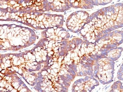 Anti-Carcinoembryonic Antigen (CEA) / CD66(Clone: SPM541)