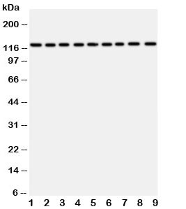 Anti-TRPC3