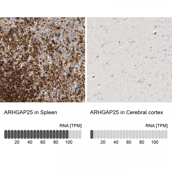 Anti-ARHGAP25