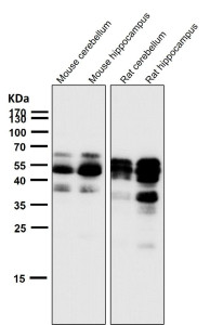 Anti-phospho-Tau (Ser404) / MAPT, clone 31M20